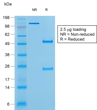 Data from SDS-PAGE analysis of Anti-Bcl-6 antibody (Clone rBCL6/1527). Reducing lane (R) shows heavy and light chain fragments. NR lane shows intact antibody with expected MW of approximately 150 kDa. The data are consistent with a high purity, intact mAb.